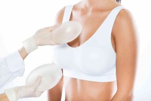 Mamoplastia de silicone: entenda o procedimento, exames e cuidados pós-operatórios